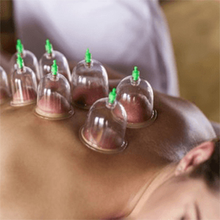 cuppingtheraphy